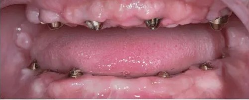Before 2